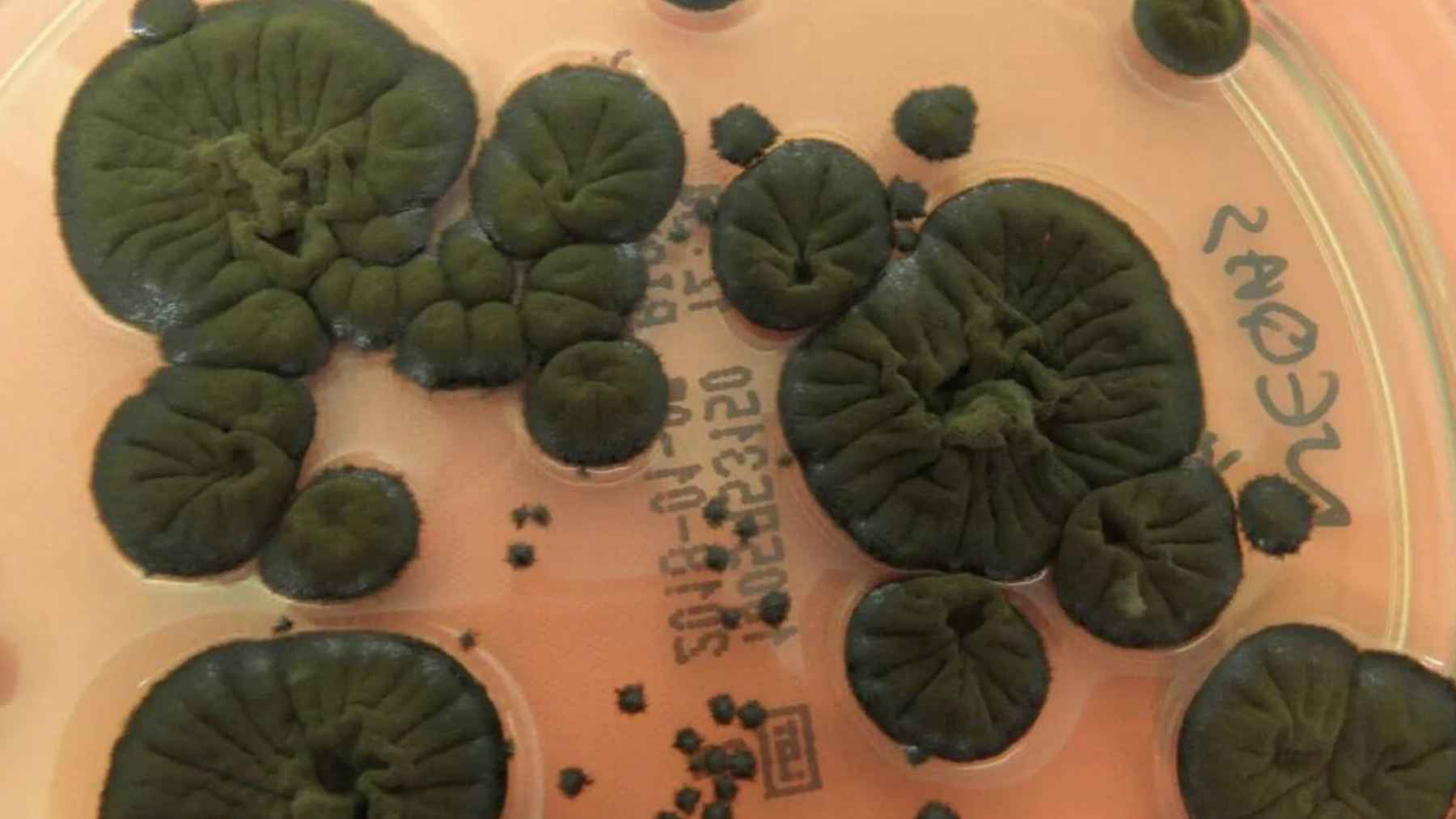 The incredible mutation of Chernobyl's black fungi that “feed” on radiation and that NASA wants to use to colonize Mars this year 1 Cladosporium sphaerospermum black fungus studied for its ability to survive high radiation and potential space applications.